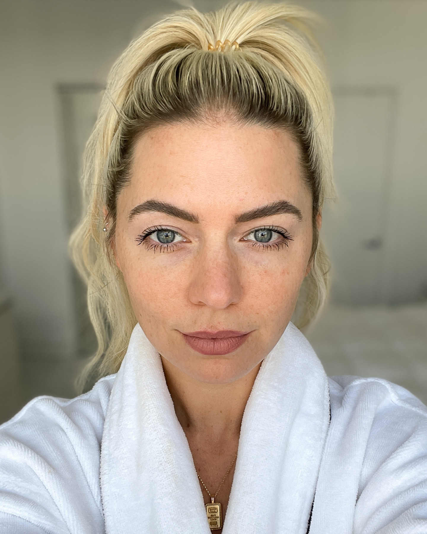 caudalie dark spot radiance serum before 