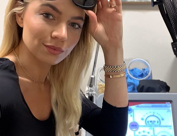 milan laser hair removal
